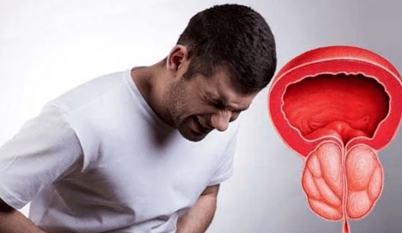 Symptome und Behandlung